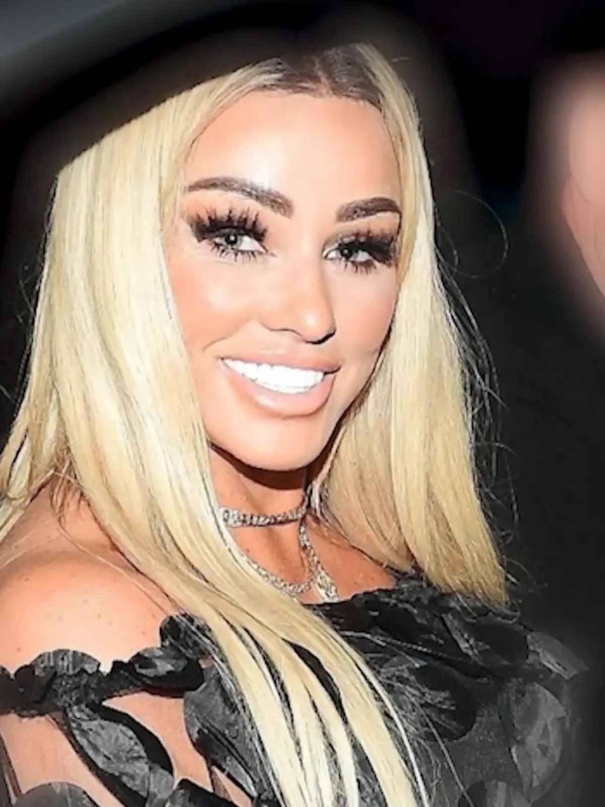 Bild zu: "Katie Price nach Beauty-OP komplett verändert"