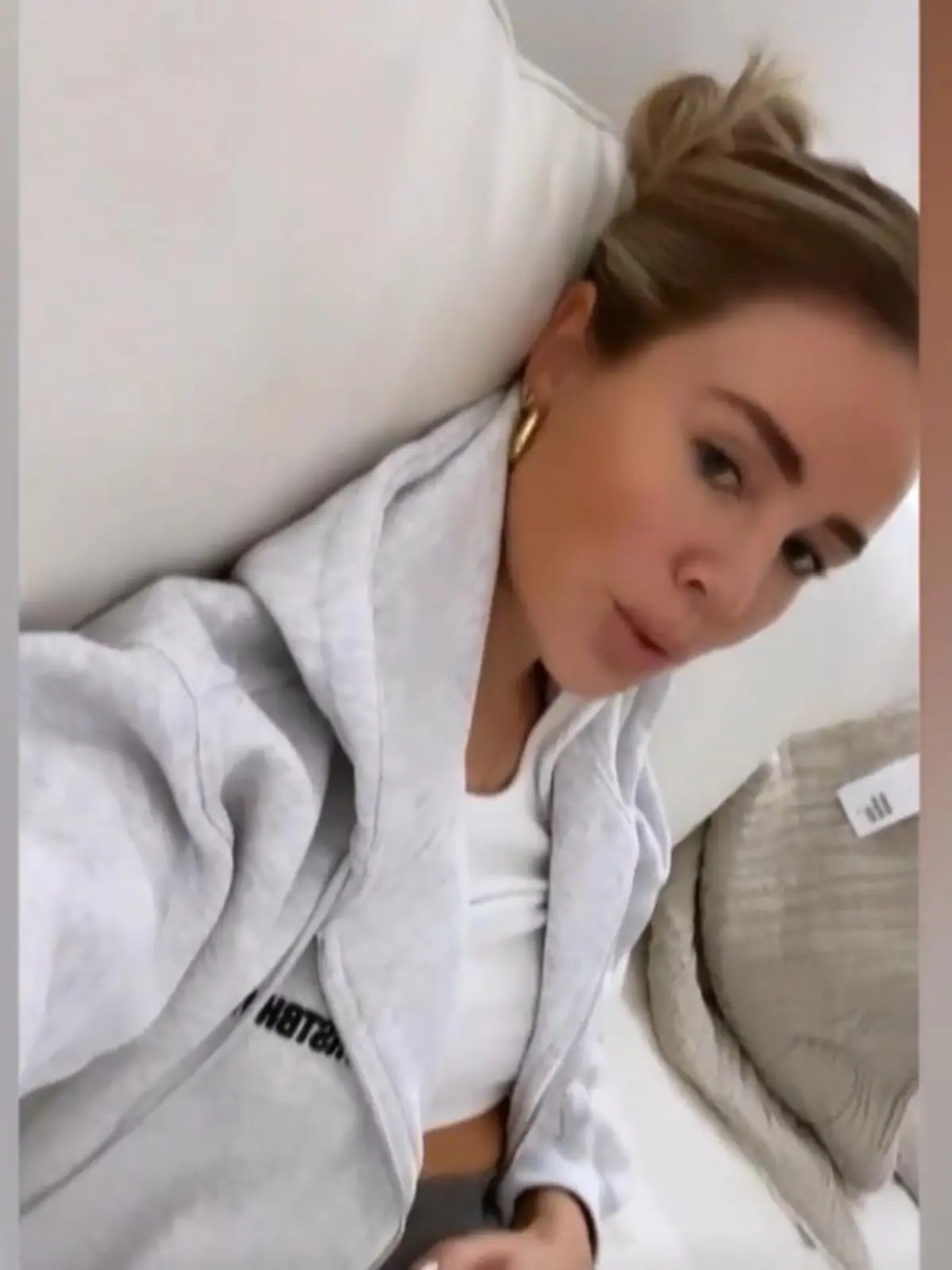 Bild zu: "Liz Kaeber zeigt ihre OP-Wunden"