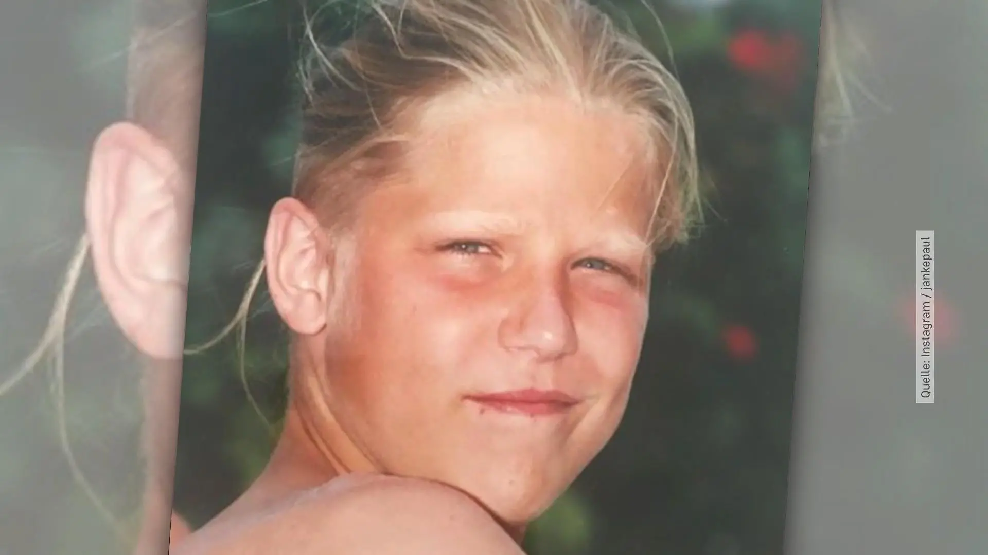Welcher Promi verbirgt sich hier? Sonnenschein - damals & heute