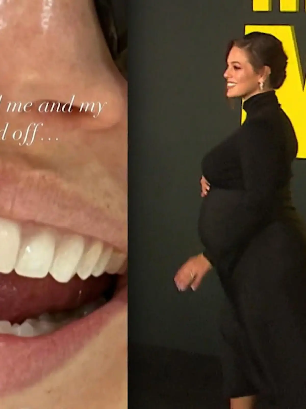Bild zu: "Ashley Grahams Zahn ist abgebrochen"