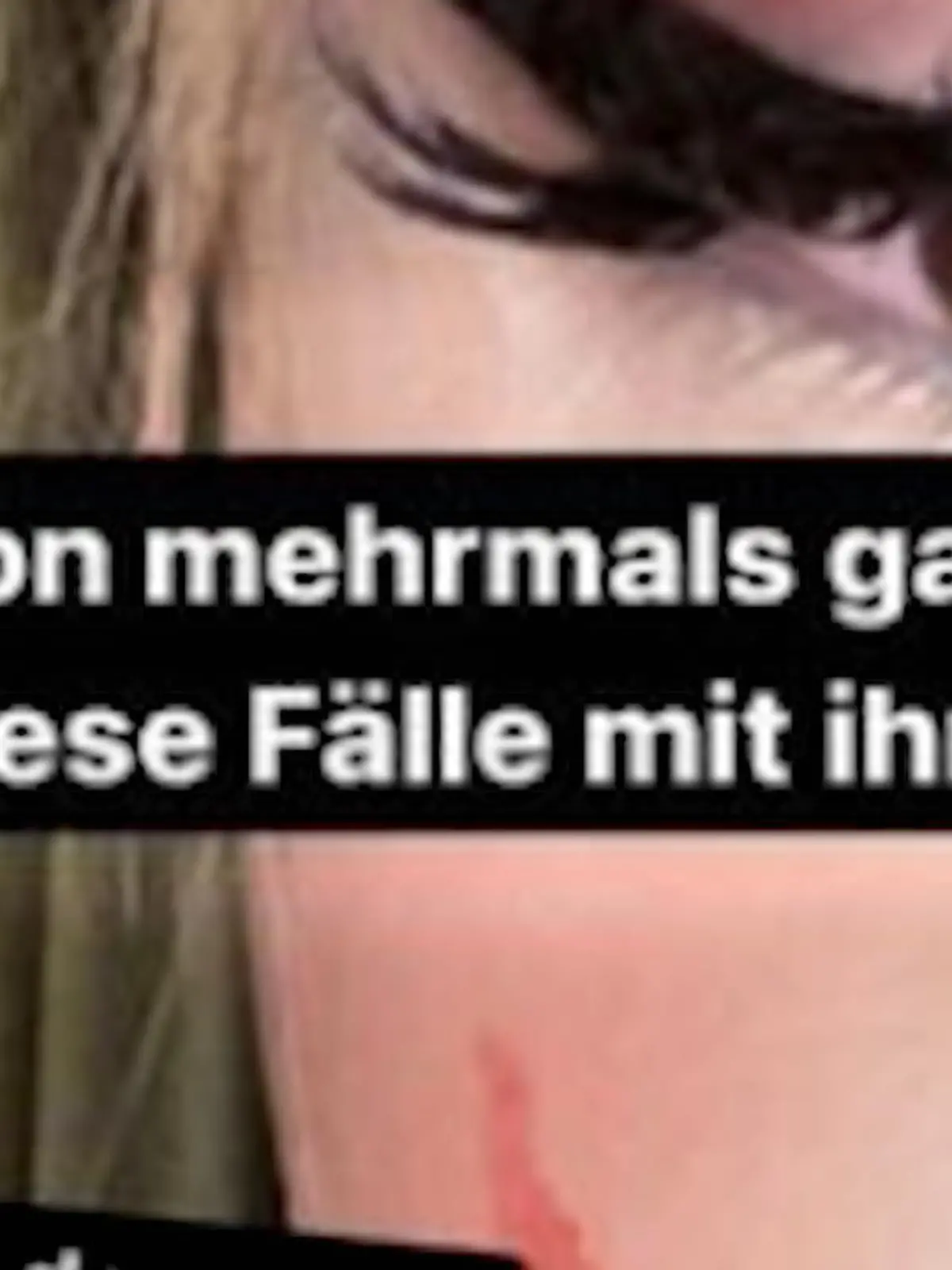 Bild zu: "Senna Gammour geschockt über Gewalt-Skandal bei Lune"