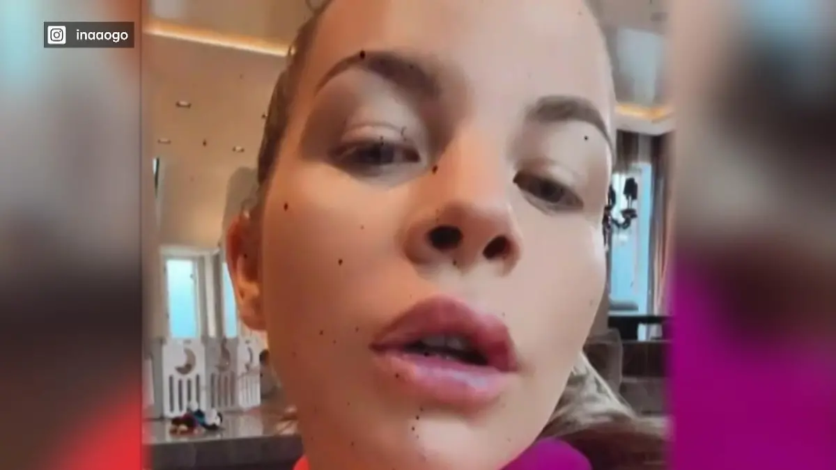 Was hat Ina Aogo mit ihren Lippen gemacht? "Erstmal nicht gesellschaftsfähig"