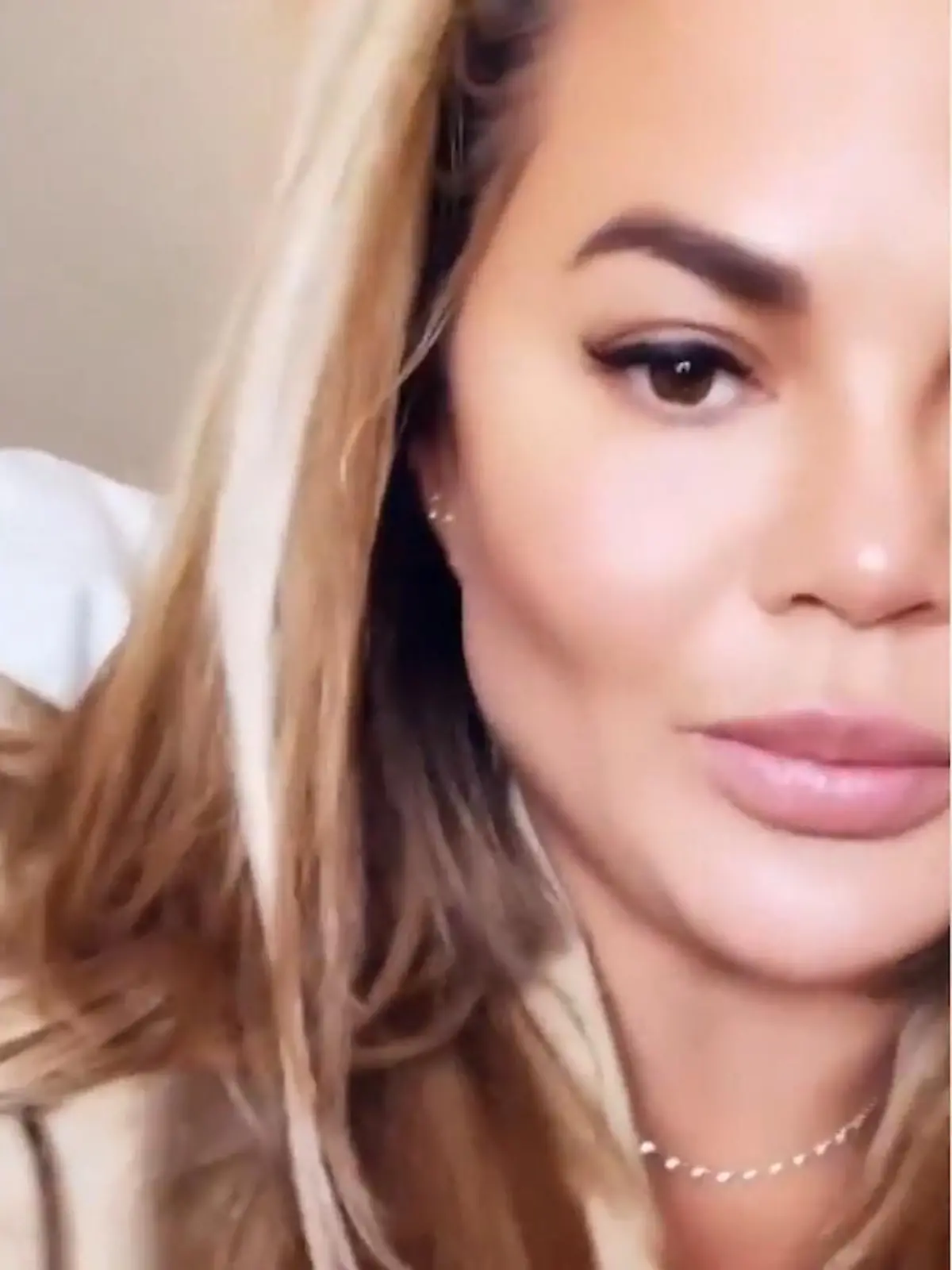 Bild zu: "Chrissy Teigen beim Beauty-Doc"
