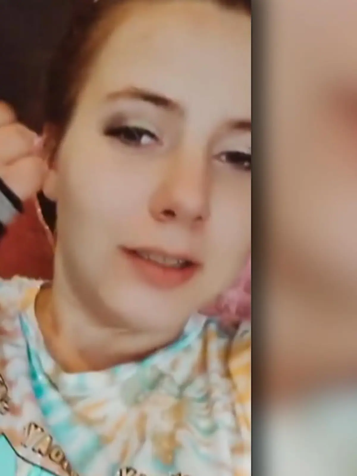 Bild zu: "Deshalb muss Sarafina Wollny eine Schiene tragen"