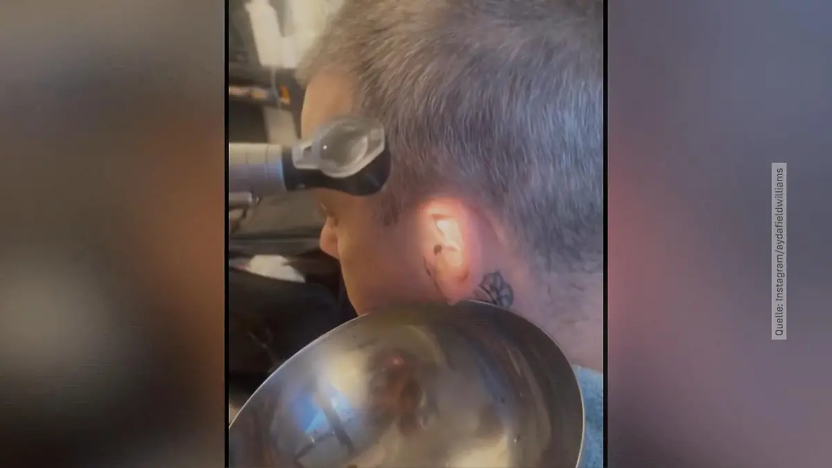 Iiihhh! Hier wird Robbie Williams' Ohr gereinigt Achtung, Ekel-Content!