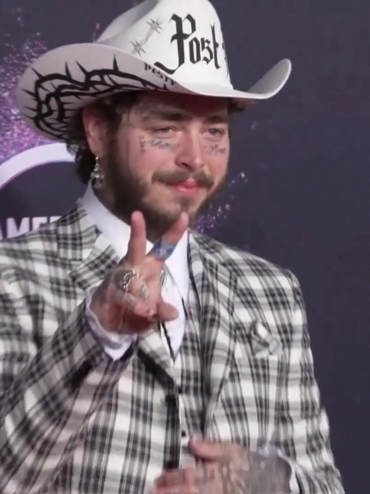 Bild zu: "Post Malone trägt jetzt Millionen-Grillz"