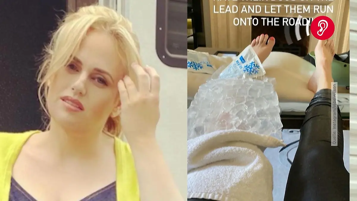 "Pitch Perfect"-Star Rebel Wilson erleidet Fahrradunfall Bettruhe ist angesagt!