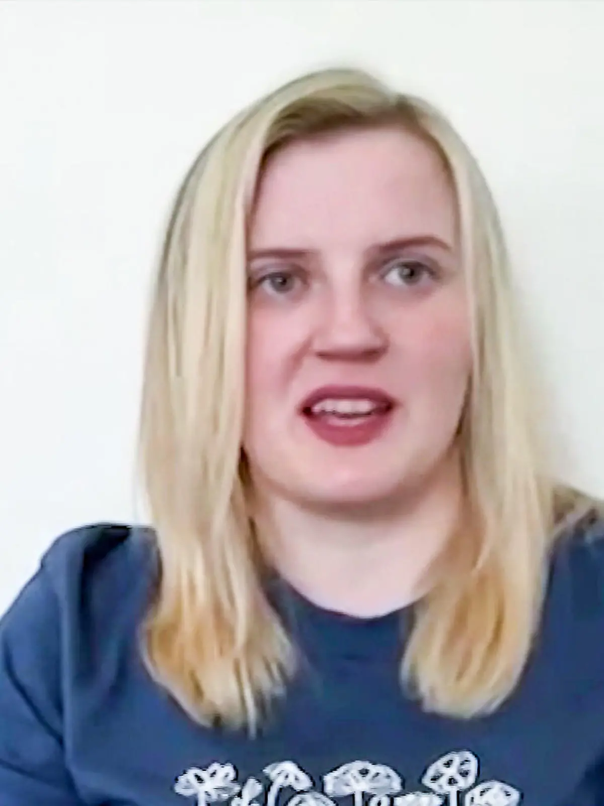 Natasha Coates (27) leidet am Mastzellenaktivierungssyndrom.