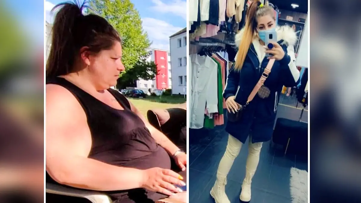 Joana vor und nach ihrer Schlauchmagen-OP.