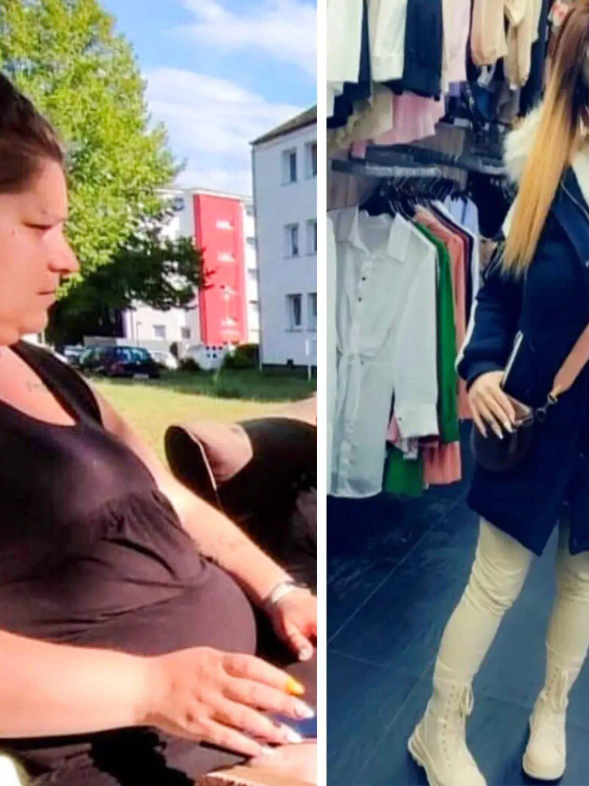 Joana vor und nach ihrer Schlauchmagen-OP.