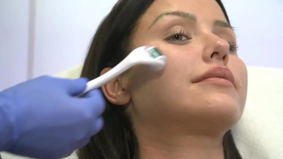 Darum lässt Kim Gloss so viele Schönheitseingriffe machen Vampirlifting und Co