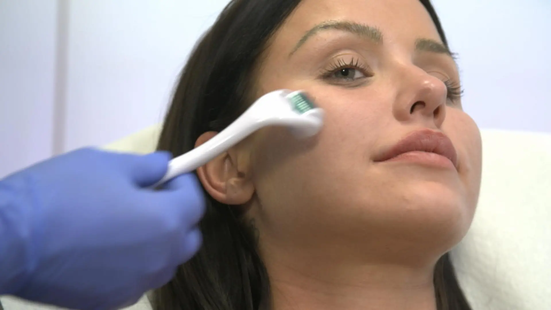 Darum lässt Kim Gloss so viele Schönheitseingriffe machen Vampirlifting und Co