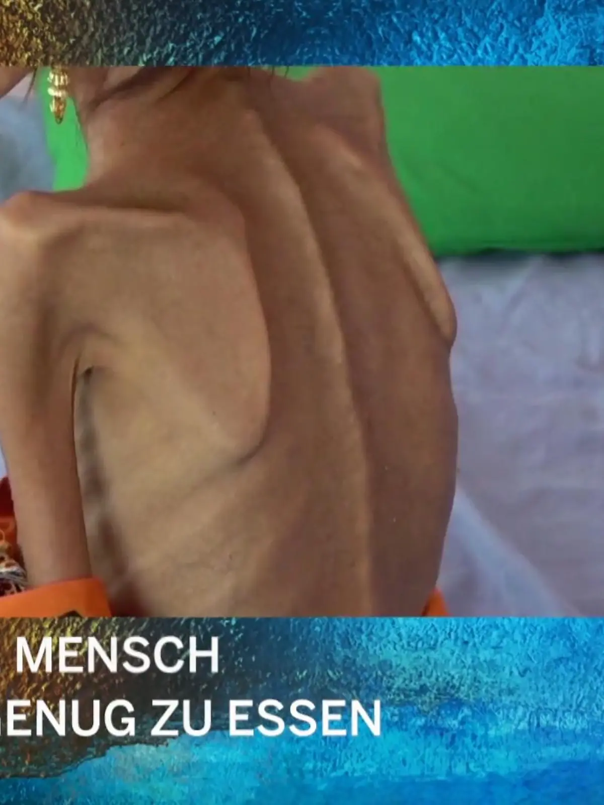 Bild zu: "Hunger Weltweit"