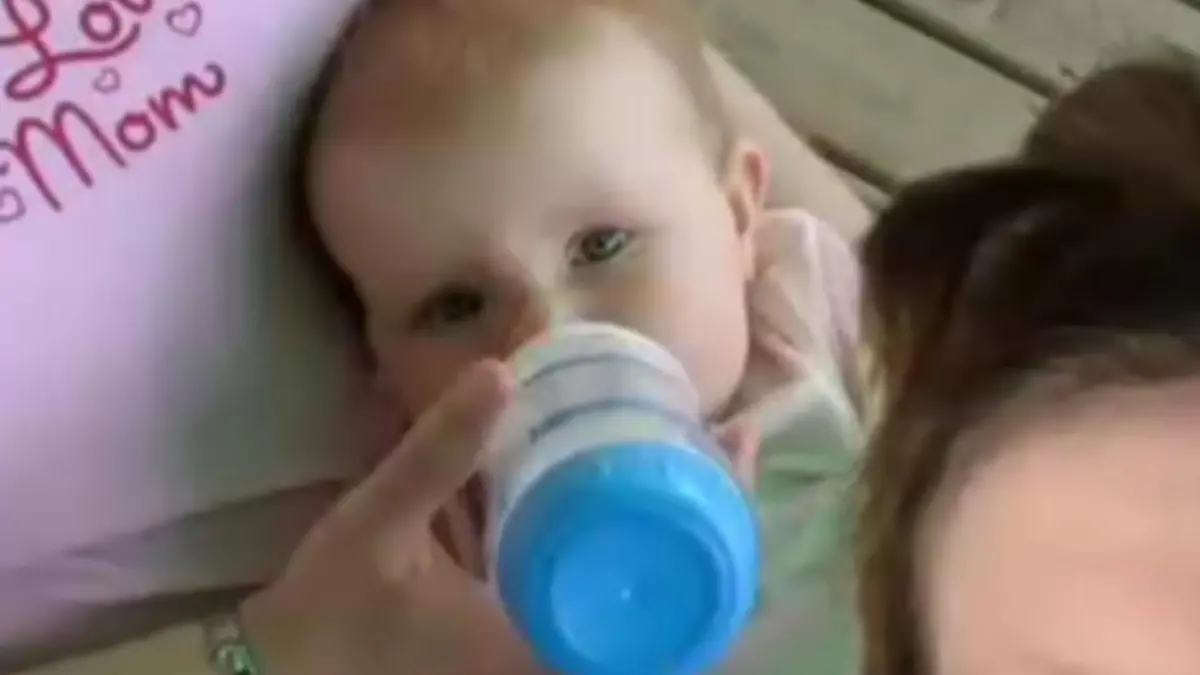 Kaleys als Baby mit Wölbung auf Stirn