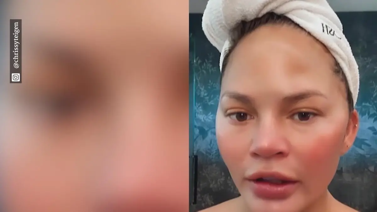 Chrissy Teigens Lieblings-Instagram-Filter ist weg! Empörtes Instagram-Comeback