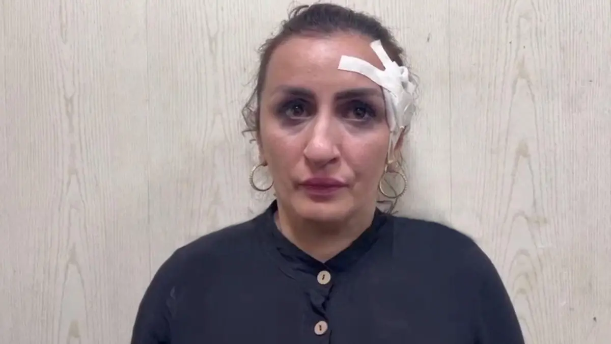 A detained woman who sold her newborn child for 200,000 rubles to get money for plastic surgery in Kaspiysk, Russia. (@mvd_dagestan/Newsflash)