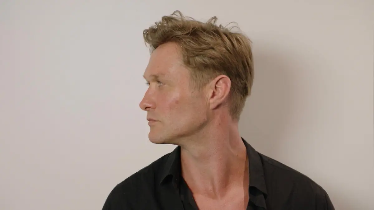 Nico Schwanz unterzieht sich Mascu-Look-Therapie Für ein männlicheres Kinn beim Beauty-Doc