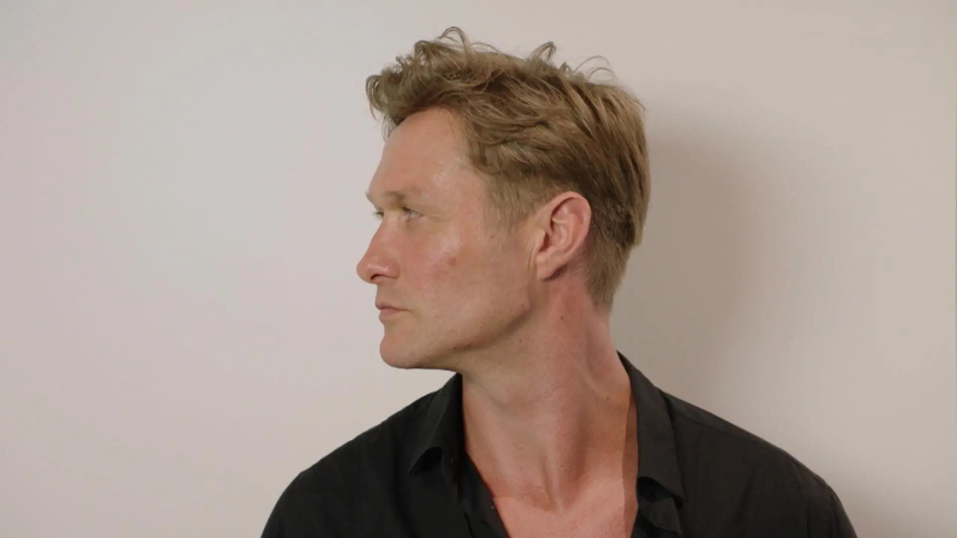 Nico Schwanz unterzieht sich Mascu-Look-Therapie Für ein männlicheres Kinn beim Beauty-Doc