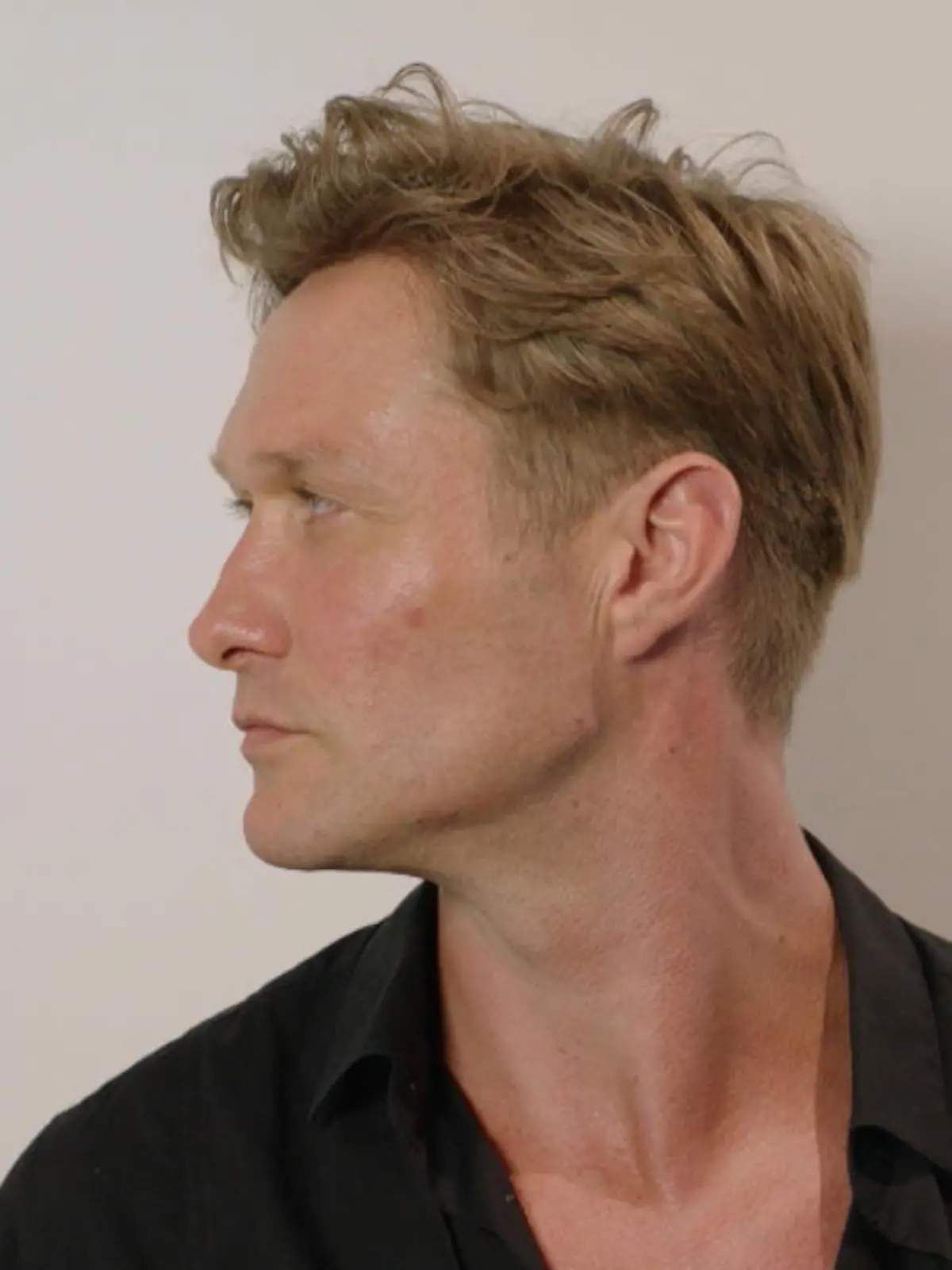 Bild zu: "Nico Schwanz unterzieht sich Mascu-Look-Therapie"