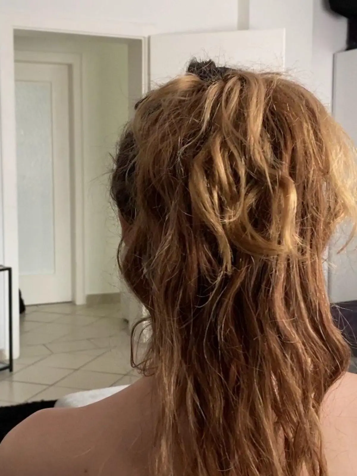 Die junge Prostituierte Joanna wurde brutal angegriffen. Sie sagt: "Sie wollten mich anzünden"