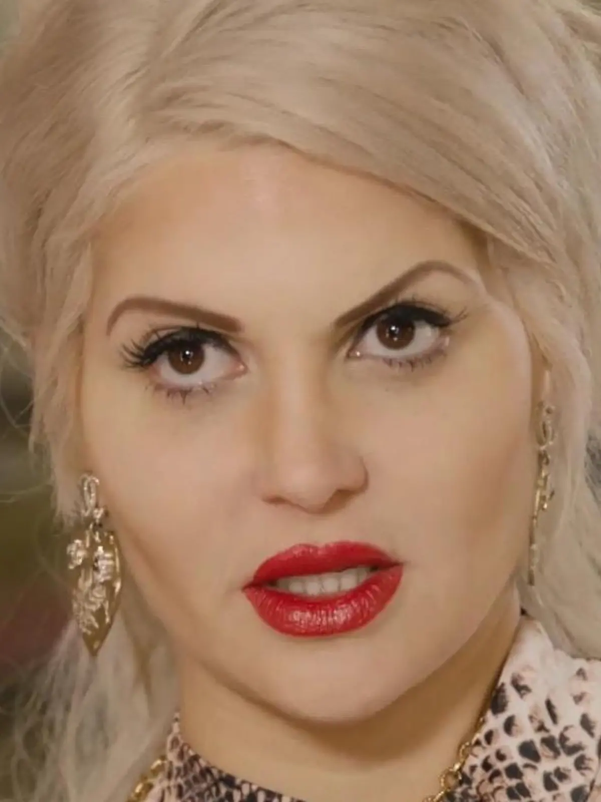 Bild zu: "Warum Sophia Vegas erneut unter's Messer musste"