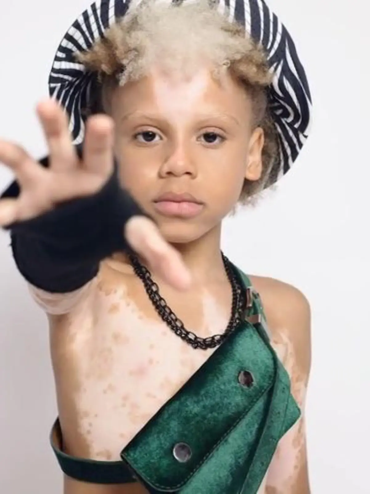 Die Geschichte des kleinen Samuel Silva ist beeindruckend. Der Achtjährige hat eine seltene Form des Albinismus und überall am Körper weiße Flecken. In seiner Heimat, einer Favela in der brasilianischen Stadt Salvador, wird Samuel deshalb jahrelang gemobbt und von anderen gemieden. Doch dann wird eine Modelagentur auf den Jungen aufmerksam – eine Begegnung, die sein ganzes Leben auf den Kopf stellt.