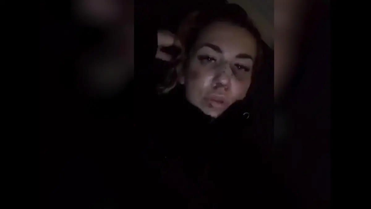 So geht es "Paradise Hotel"-Star Miri Nach E-Roller-Unfall