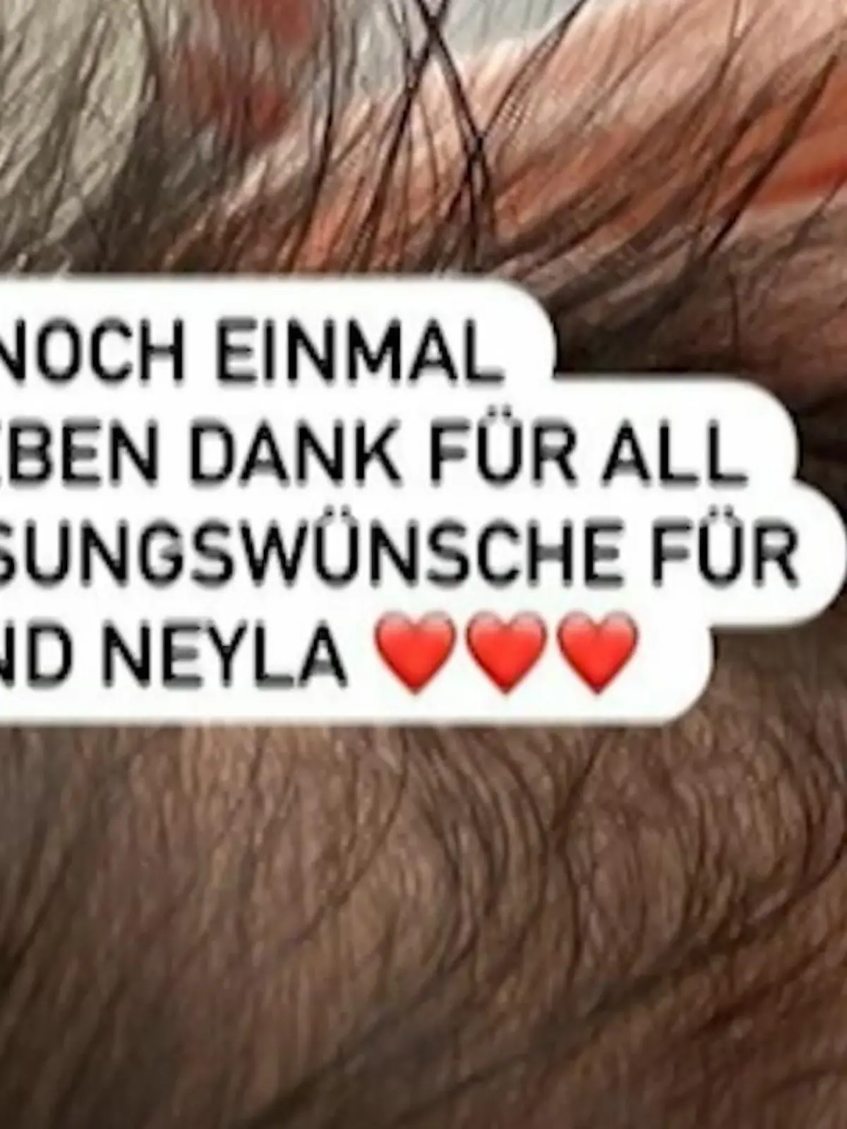 Bild zu: "OP für Fiona Erdmanns Baby?"