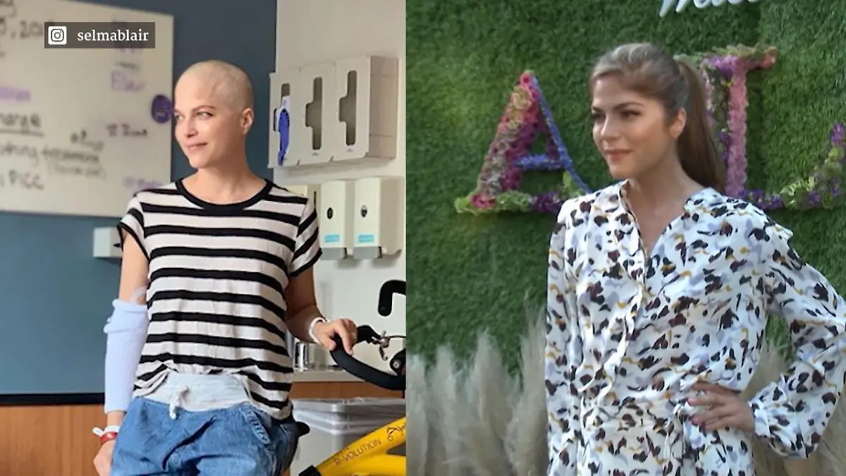 Selma Blair zeigt sich erstmals mit Glatze Emotionaler Instagram-Post