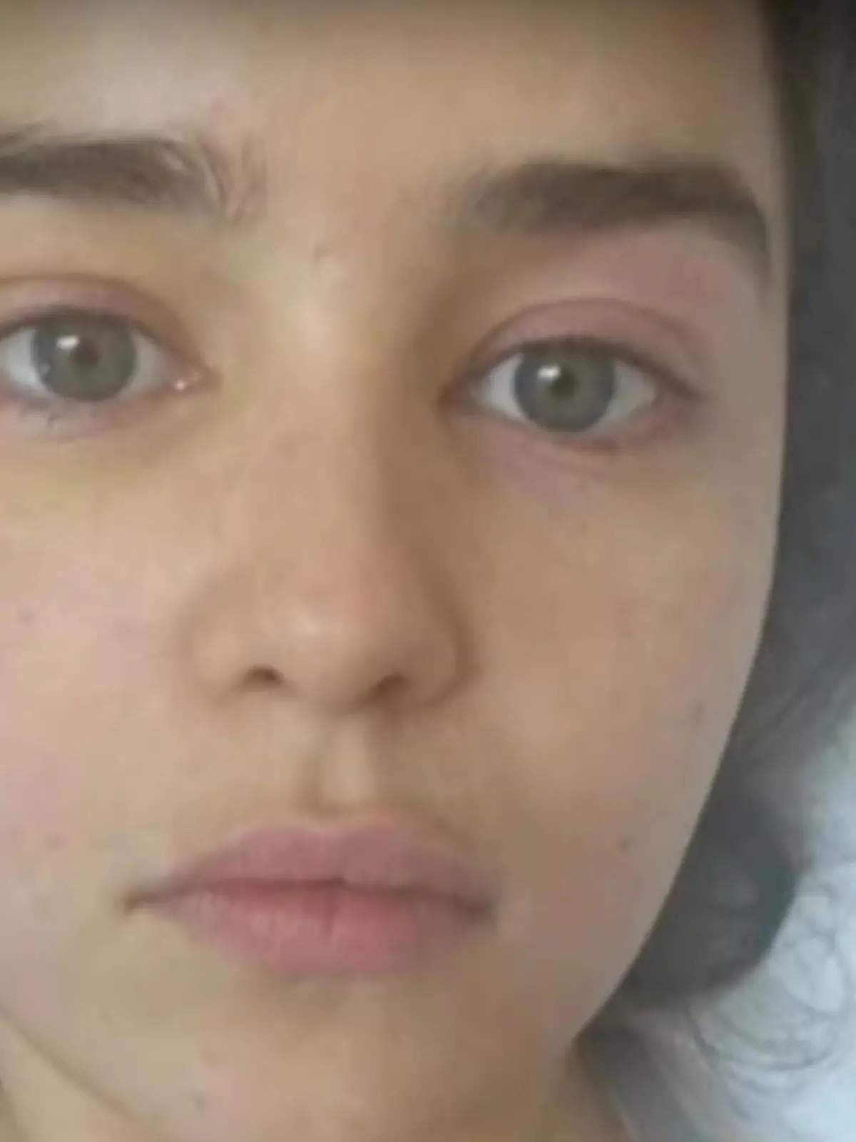 Bild zu: "Emilia Clarke zeigt Bilder nach Hirn-OP"