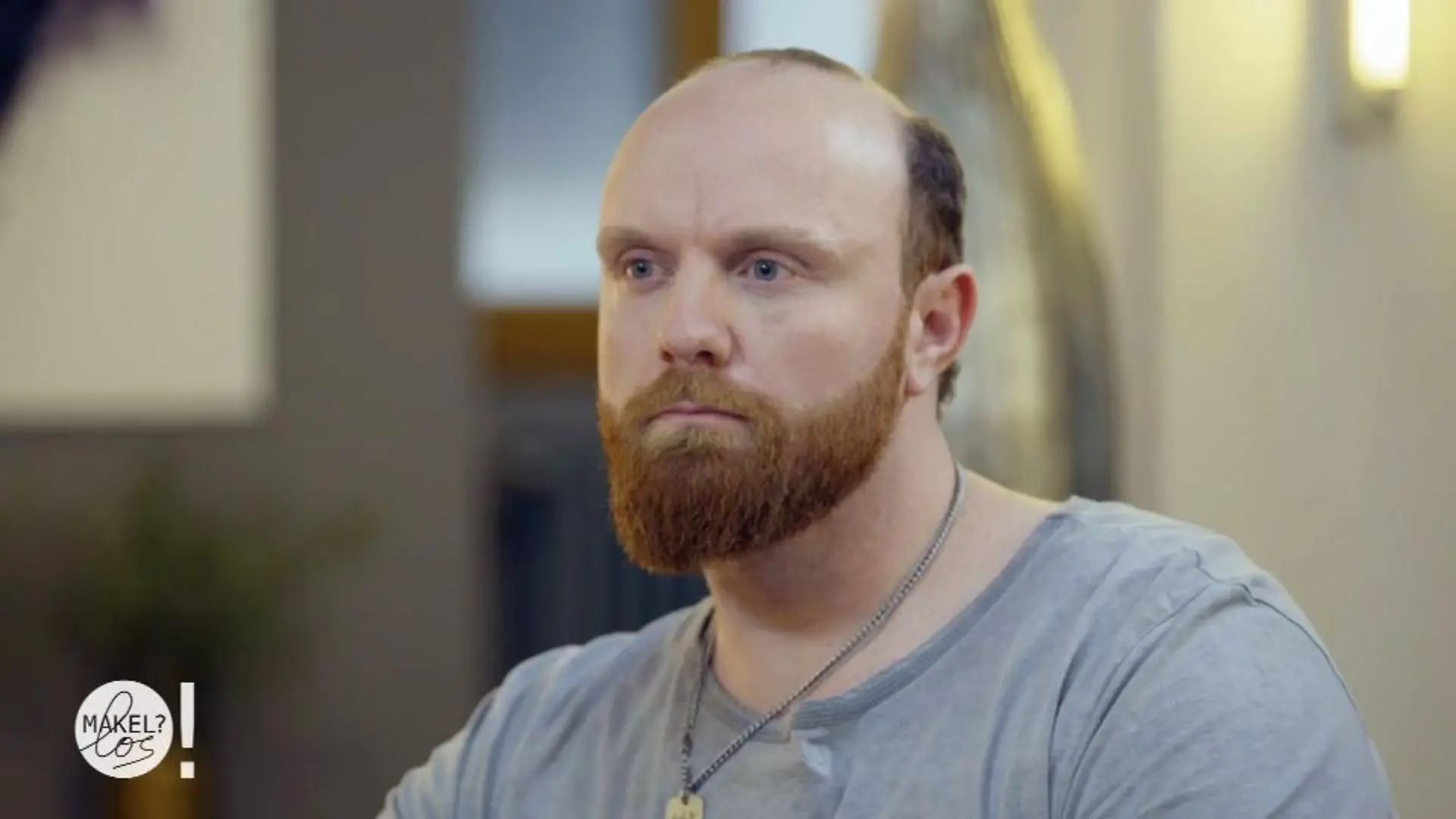 Marco sind die Haare ausgefallen "Ich gehe ohne Mütze nicht mehr raus"