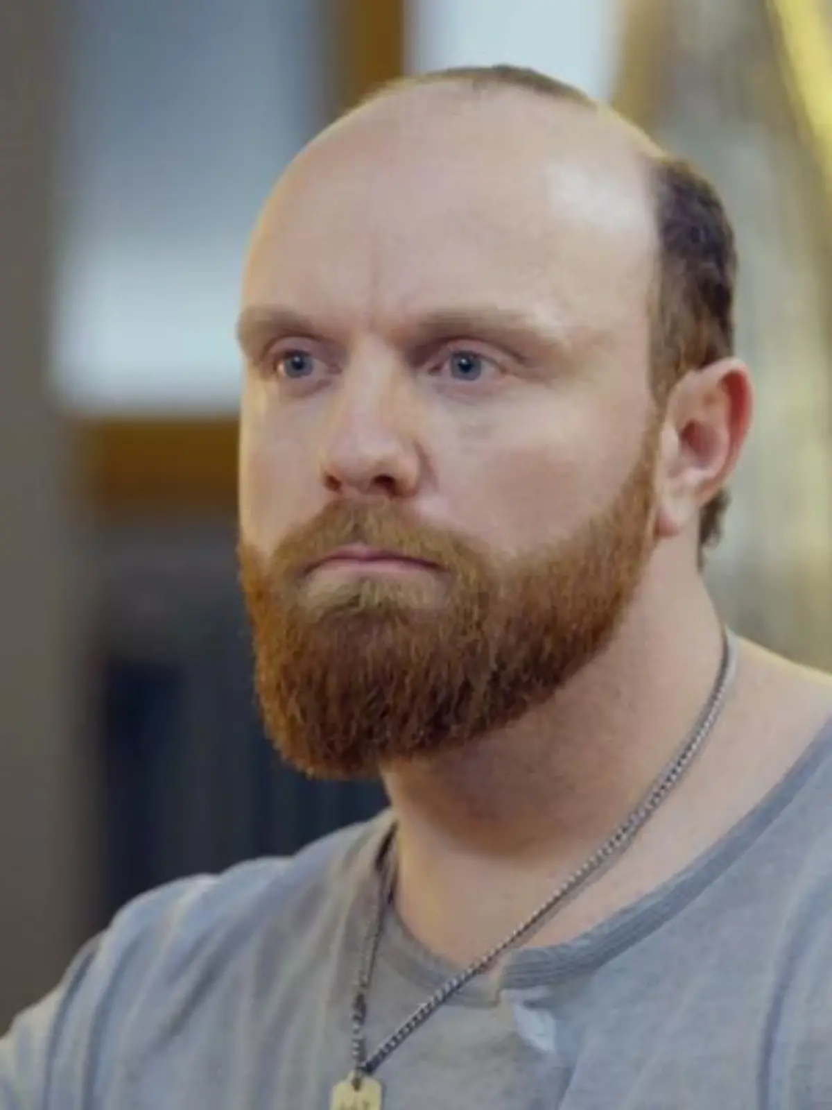 Bild zu: "Marco sind die Haare ausgefallen"