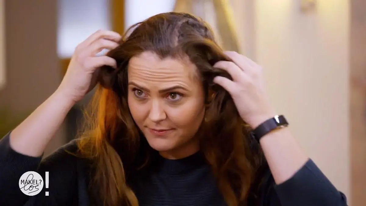 Die Experten machen Joana-Maria Hoffnung Sie wollen ihr Haarproblem lösen