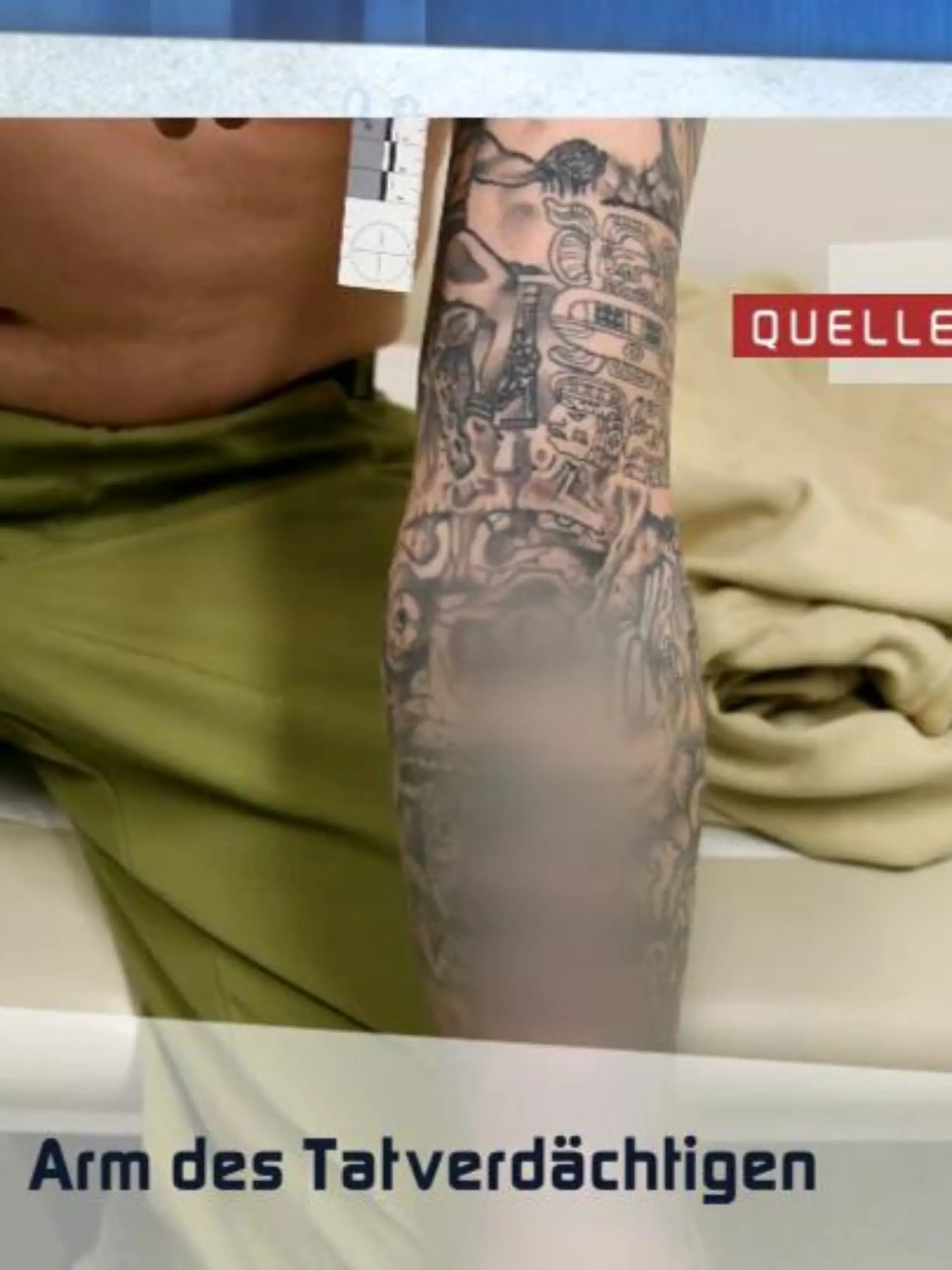 Bild zu: "Tätowierte sich Lillys Ex zur Spurenverwischung?"