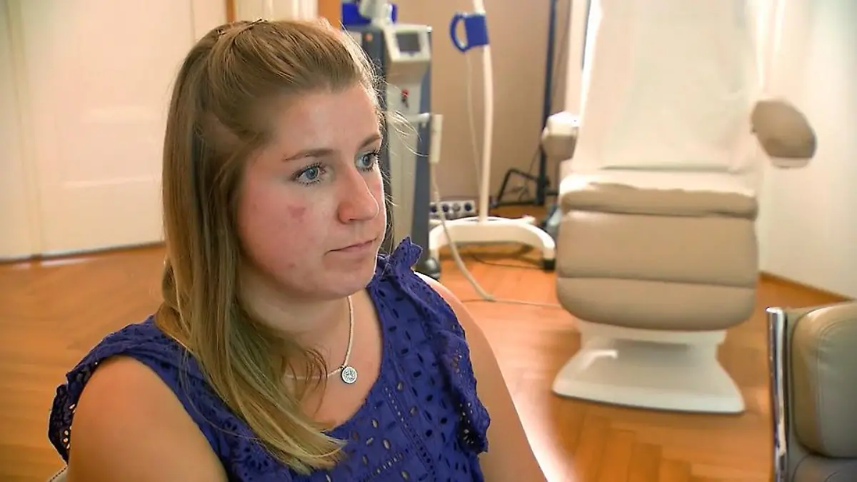 Patientin leidet stark unter Akne Sie fühlt sich nackt ohne Schminke
