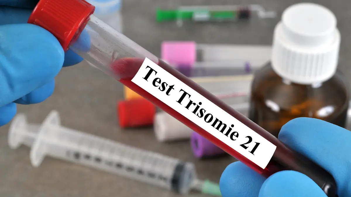 Bluttest Trisomie