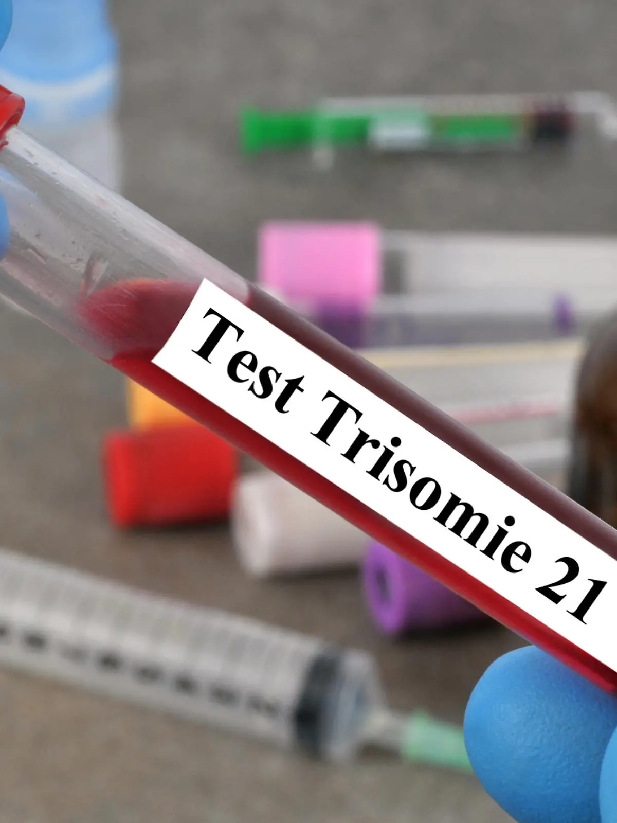 Bluttest Trisomie