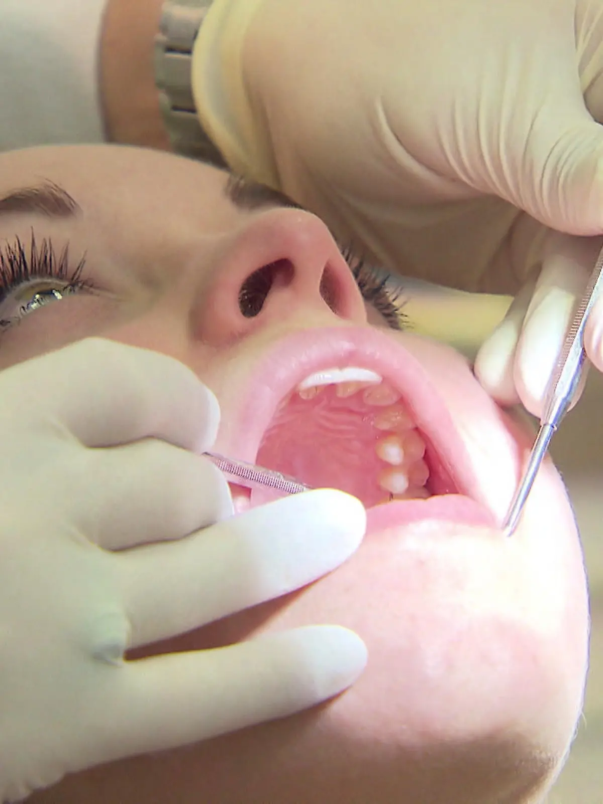 Bild zu: "Verbot für Amalgam: Füllstoff muss ersetzt werden"