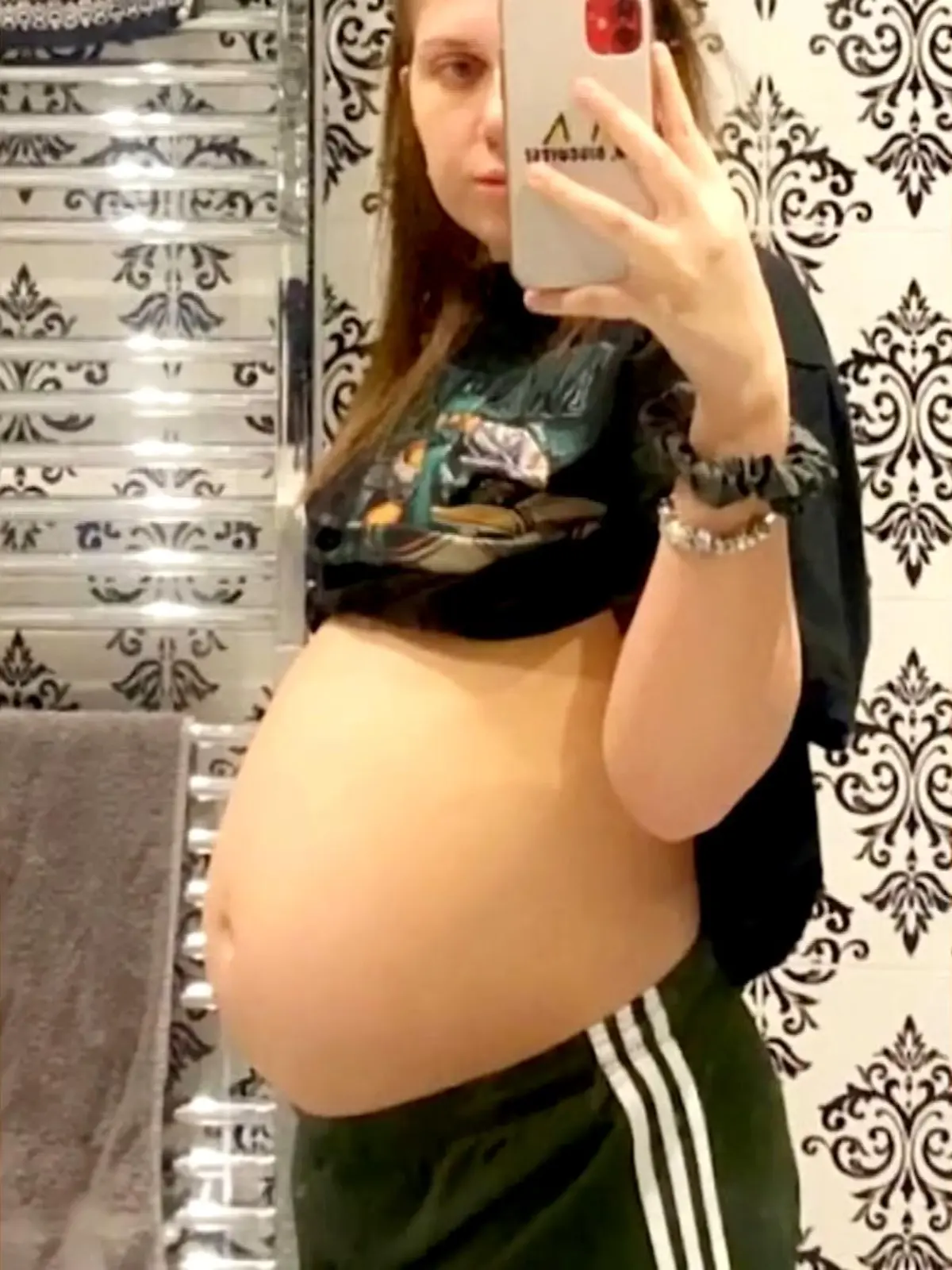 In diesem Bäuchlein wächst doch bestimmt ein Baby heran! Oder etwa nicht? Falsch gedacht! Hollie Welham (21) hat nämlich mit einer 27 (!) Zentimeter großen Zyste zu kämpfen und muss sich einer OP unterziehen.