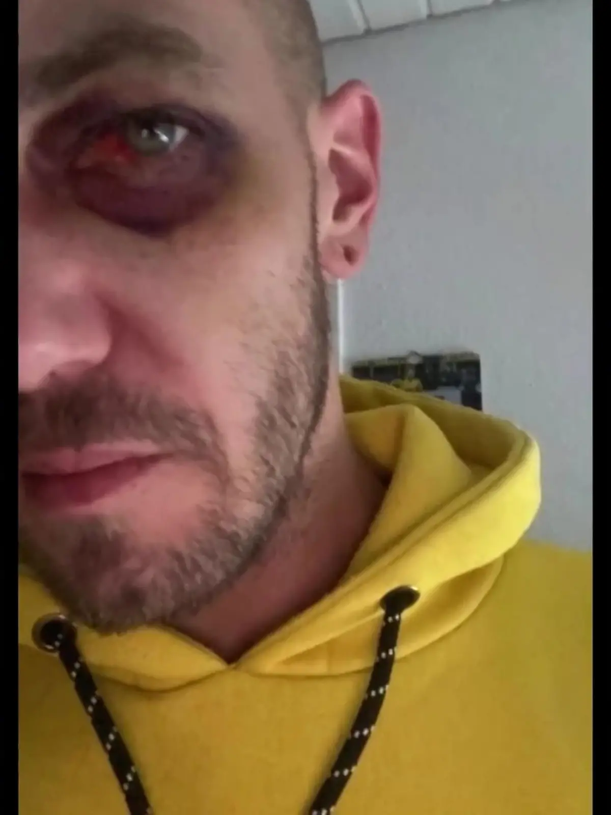 Bild zu: "Fahrgast ins Koma geprügelt"