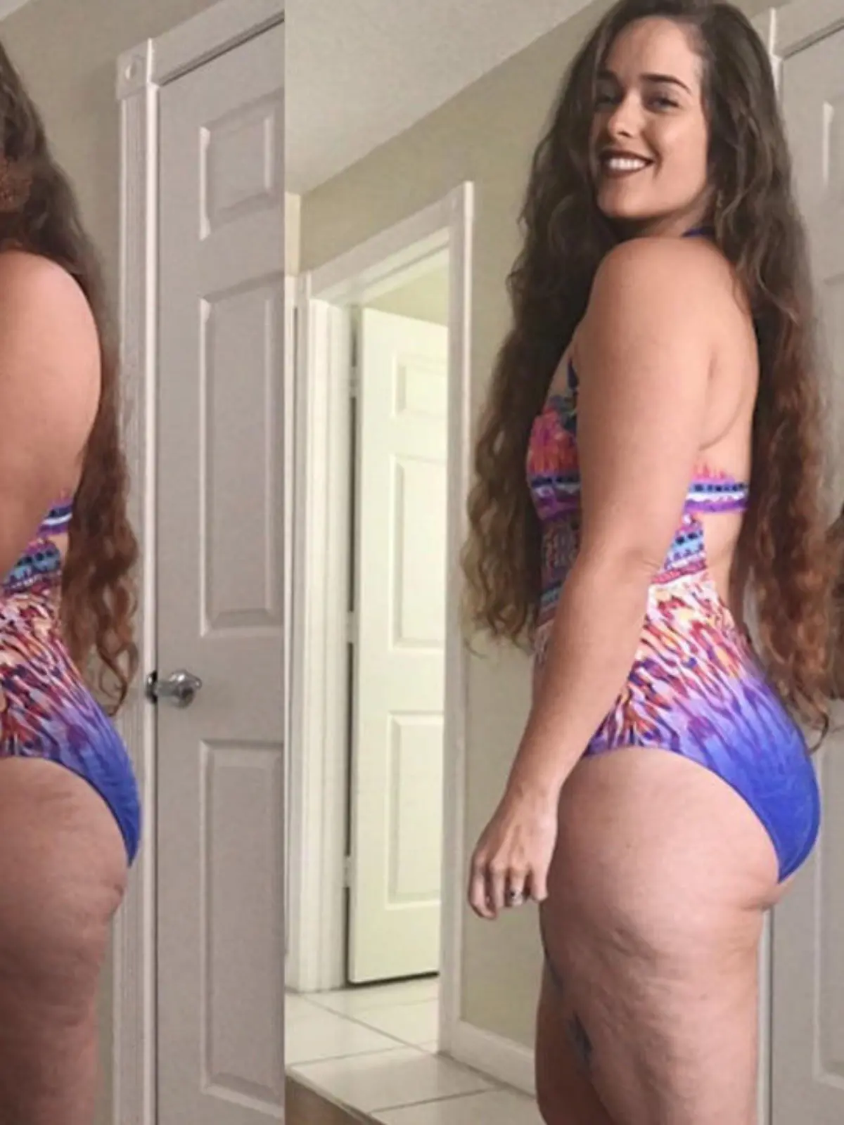 Bild zu: "Löschte Instagram dieses Foto wegen Cellulite-Dellen?"