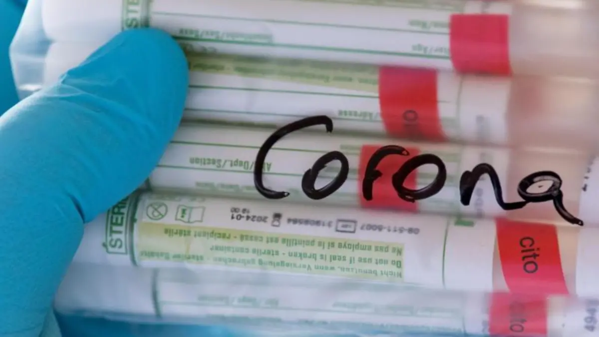 Corona-Tests