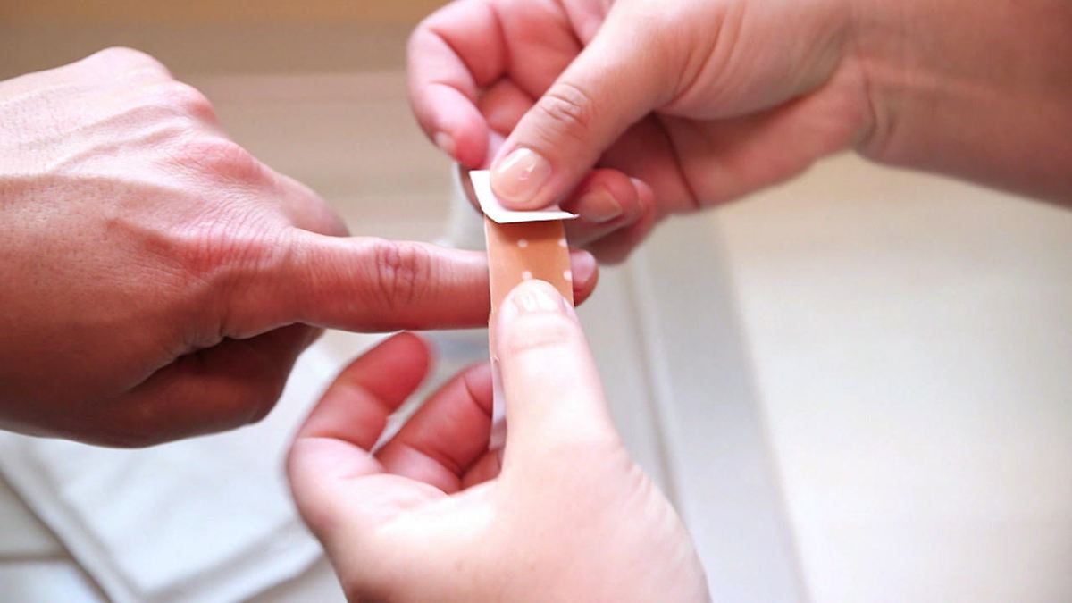 Hier tummeln sich besonders viele Bakterien: Wunde an Hand oder Finger