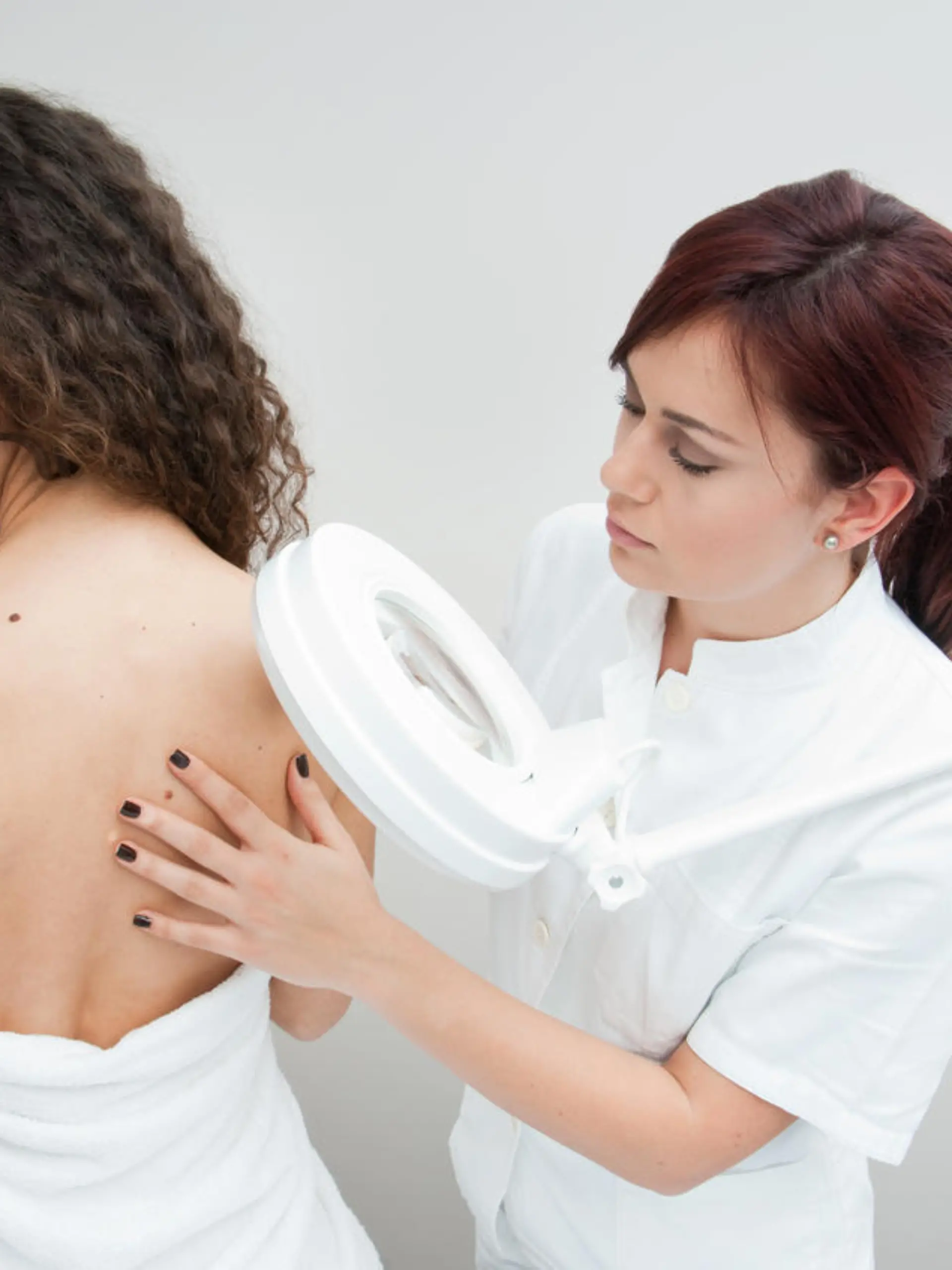 dermatologist doctor inspecting woman skin for moles and melanoma