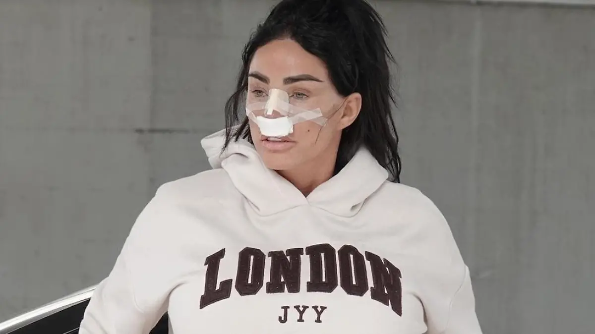 SONDERKONDITIONEN: MINDESTHONORAR: BGUK_2683859 - BRUSSELS, BELGIUM - *EXCLUSIVE* - 
The British Model Katie Price is all bandaged up after undergoing a nose job, a lip lift along with an abdominal etching surgery at the BeClinic in Belgium as the former Glamour model recovers from her surgery procedures!
Pictured: Katie Price - Jordan
BACKGRID UK 11 JULY 2023 


