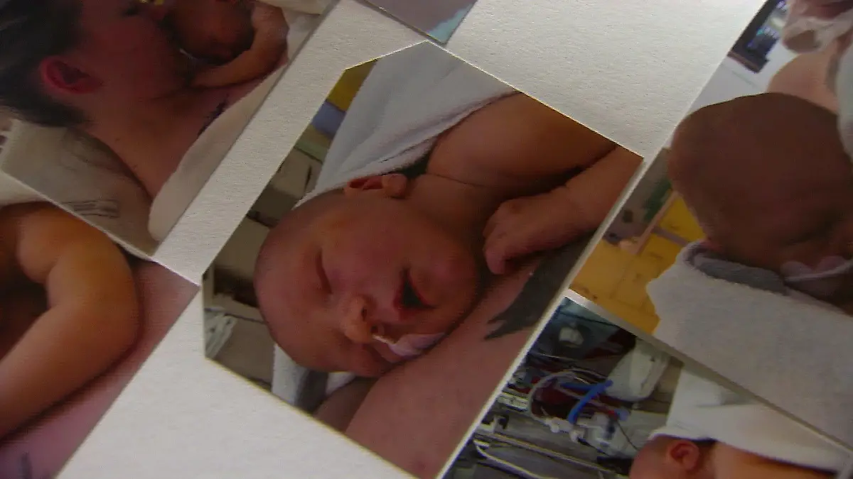 Der kleine Tebbe wird mit dem seltenen Gendefekt CTNNB1 geboren