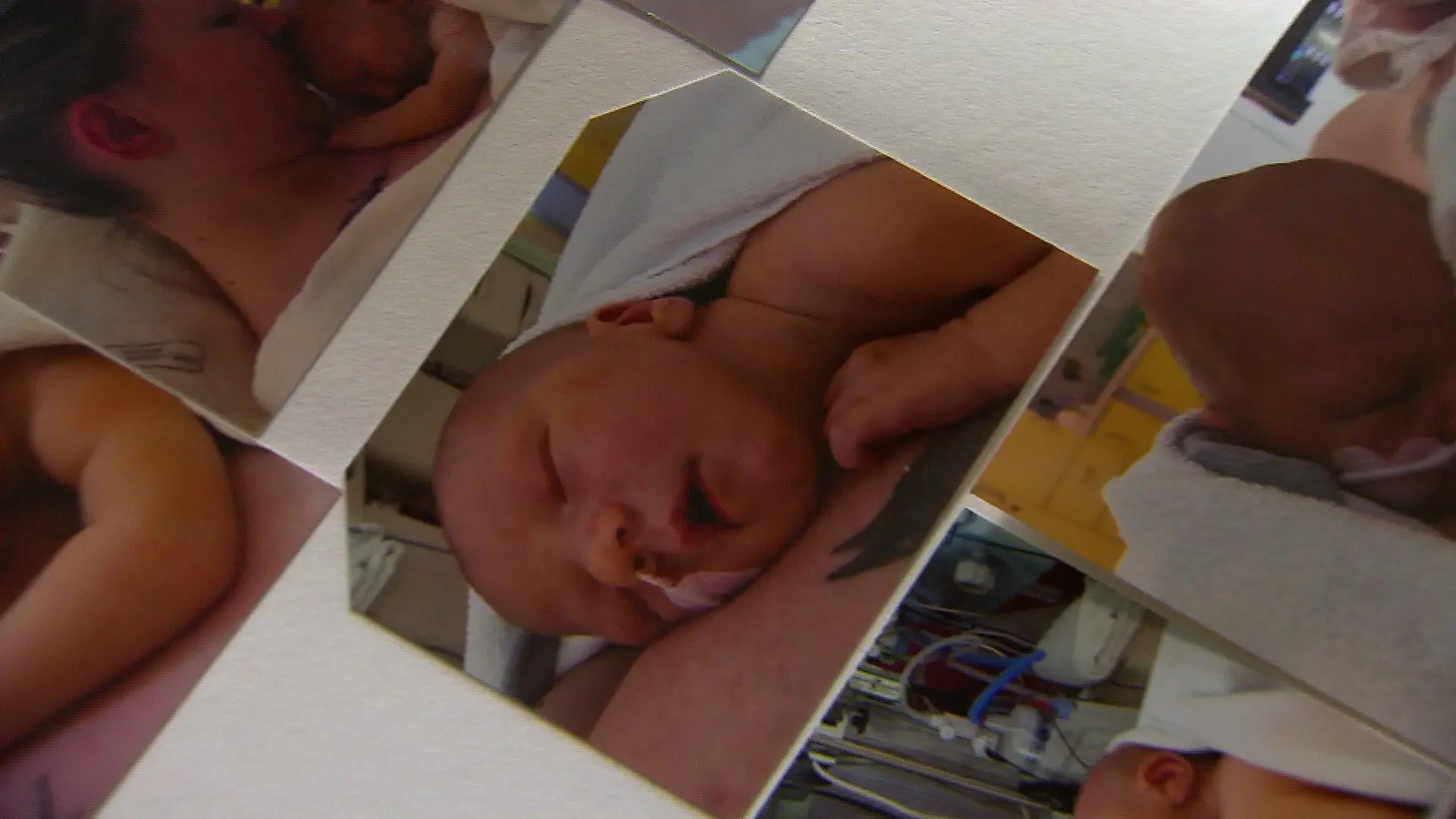 Der kleine Tebbe wird mit dem seltenen Gendefekt CTNNB1 geboren