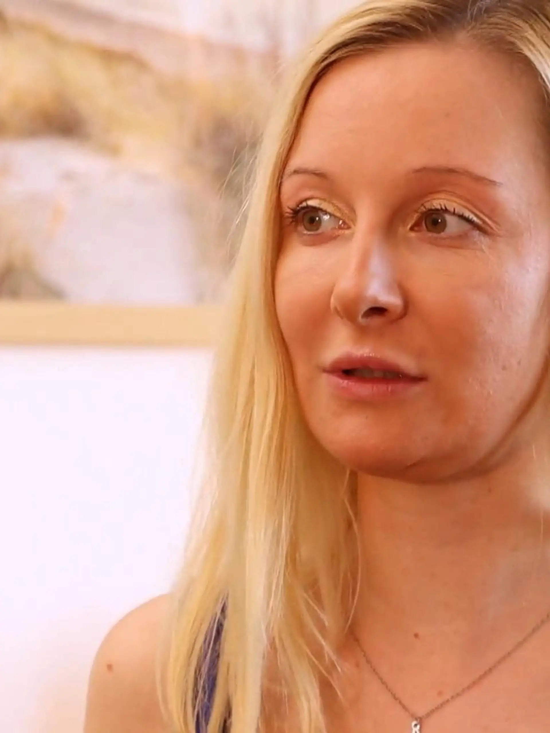 Bild zu: "Anna (31) ist allergisch gegen Wasser"