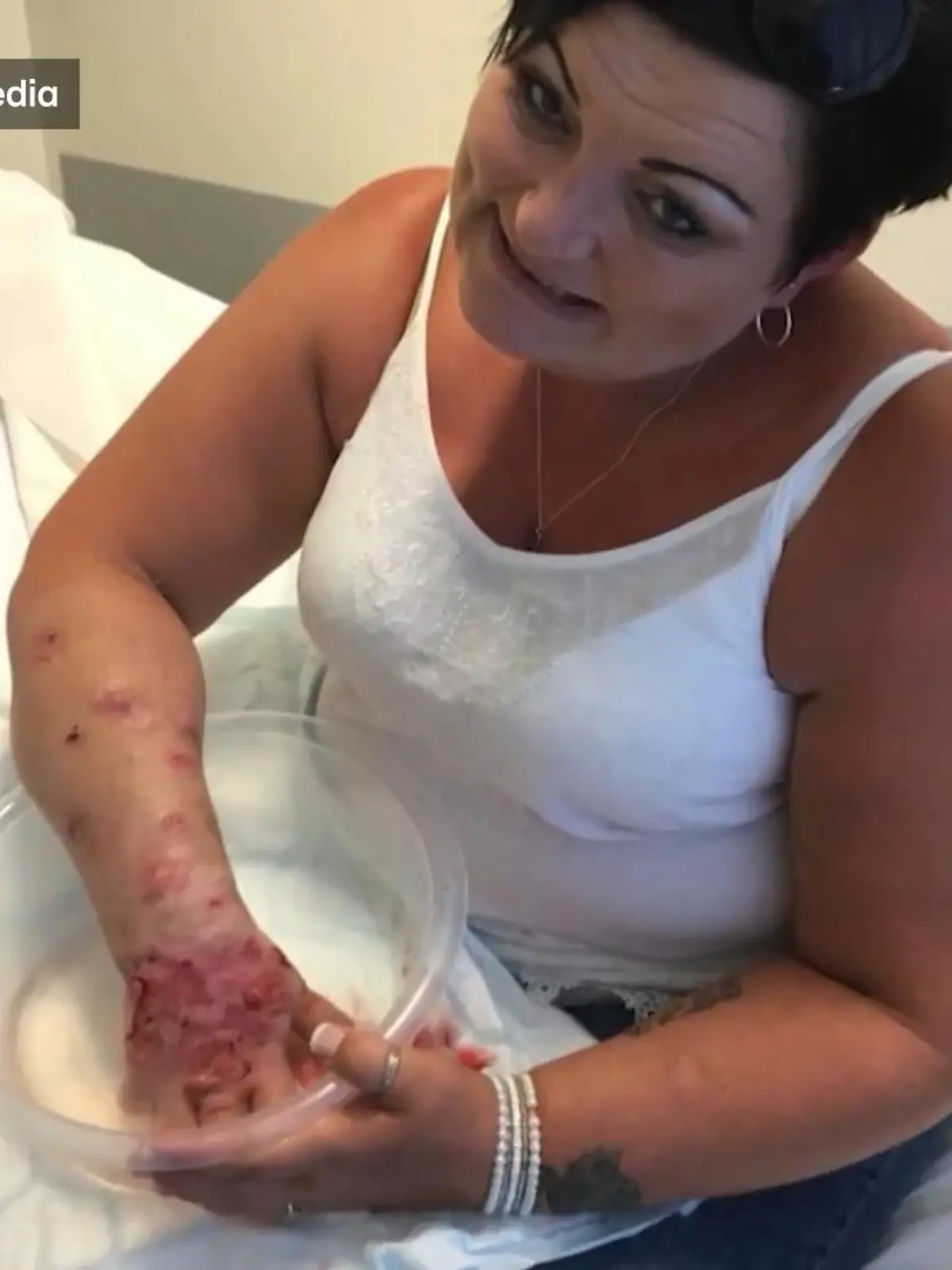 Diese Bilder sind nicht aus einem Horrorfilm, sondern tatsächlich echt. Sharon Brown hat eine riesige klaffende Wunde, die wir ihnen in diesem Fall nur geblurrt zeigen wollen.