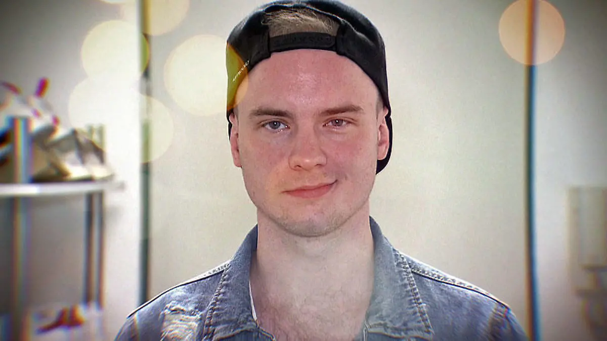 Toni Kraus leidet unter einer Gesichtslähmung